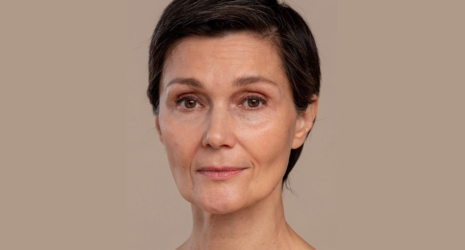 Before treatment at Dr. A Aesthetic Academy